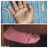 Pinkies World